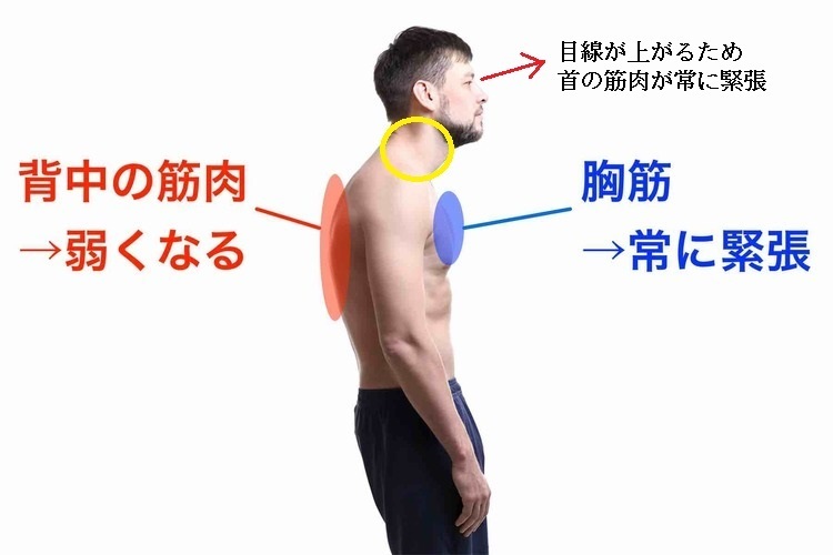 前鋸筋の痛みの症状は何ですか?